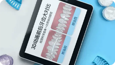 深圳隱適美價錢