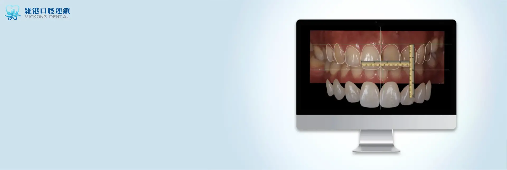 珠海拱北牙貼費用