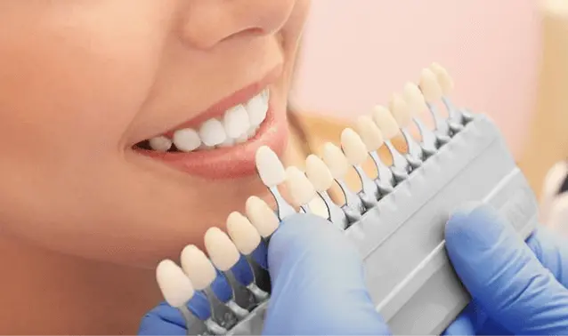 珠海拱北牙貼費用