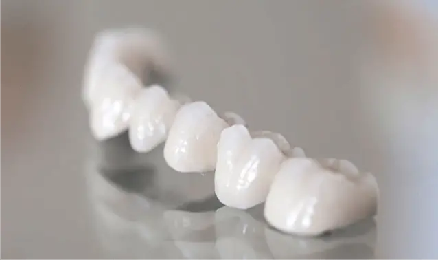 珠海拱北牙貼費用