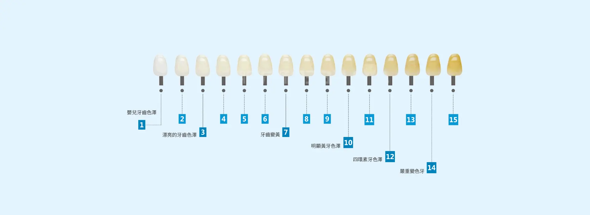 珠海拱北牙貼費用